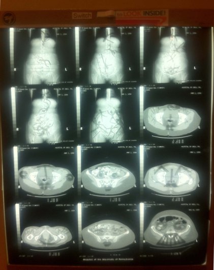  Borborygmi (2012) Light box, cut paper, CT scan 18”x 24” x 4” plus power cord
